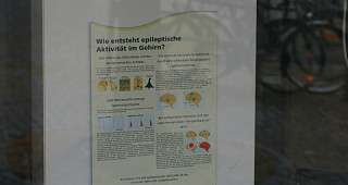 über epileptischer Aktivitat im Gehirn